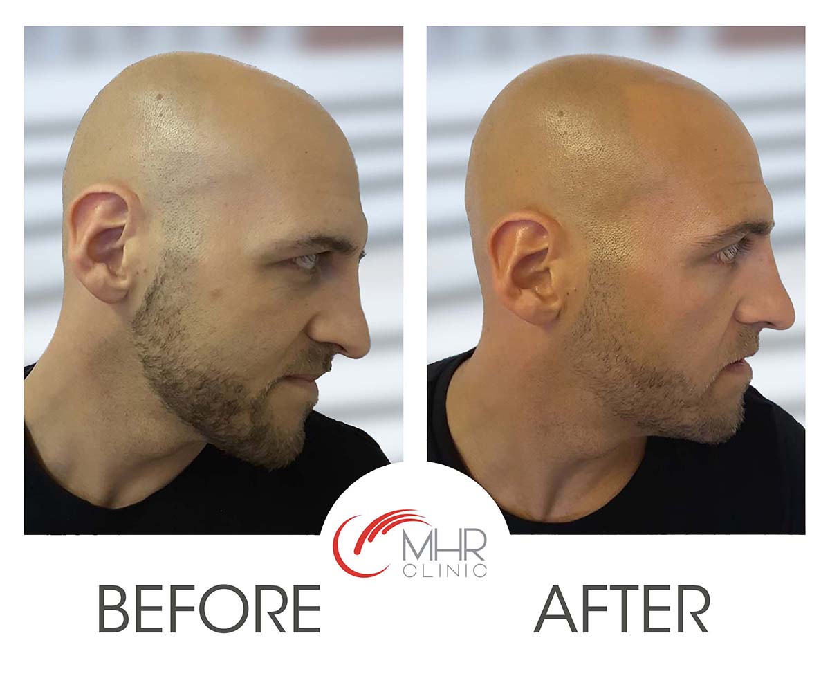 ba1b Ryan Sidebottom MHR clinic