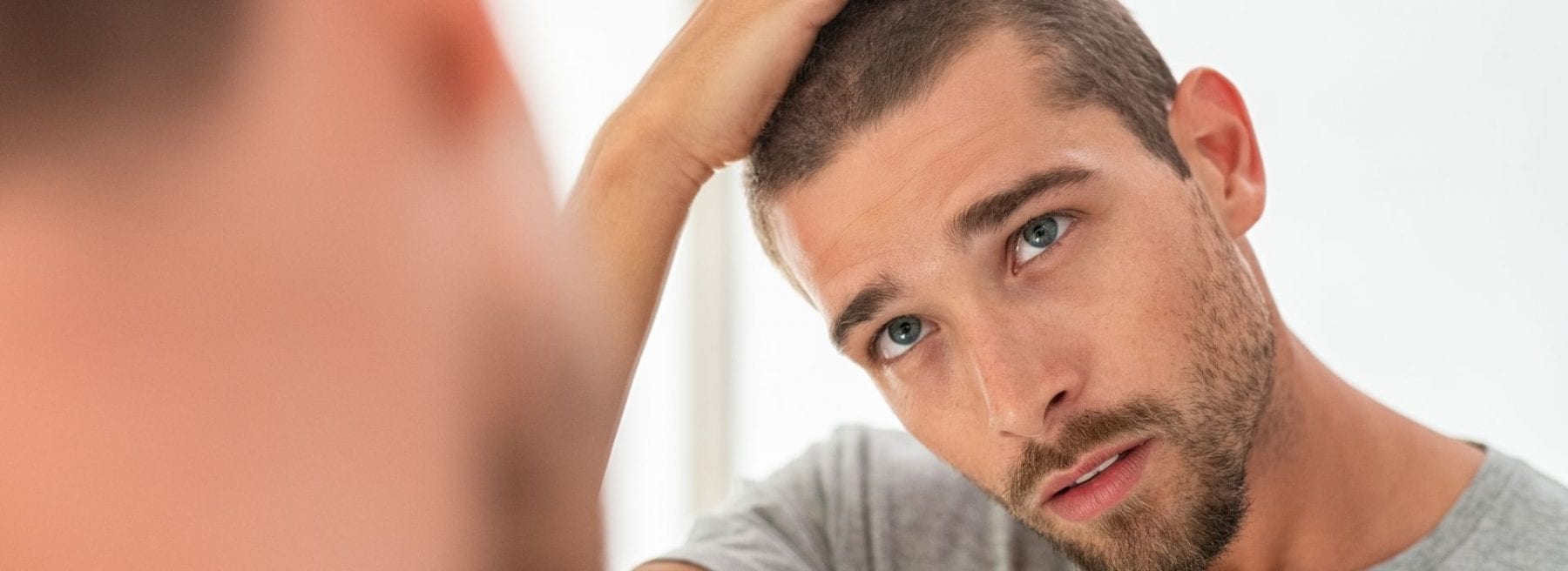 Young man aged 20-30 balding Signs of balding at 20 years old in males.
