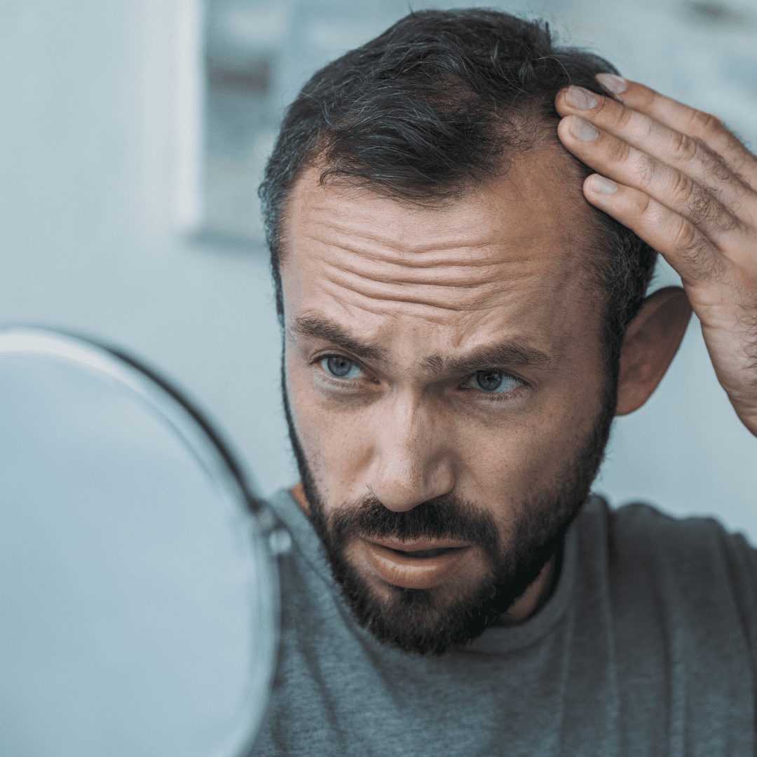 Man worried about hair falling out as seen in dreams Concerns about hair falling out in dreams