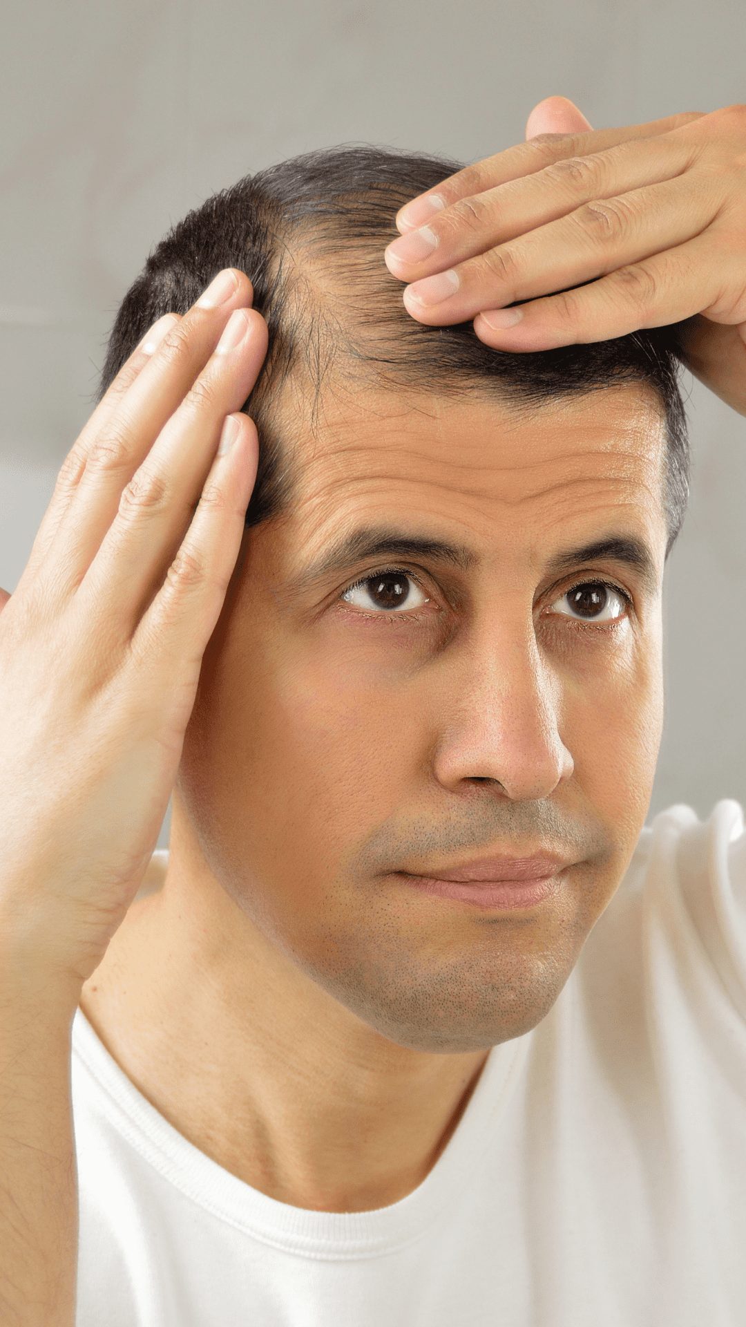 Hair loss as a result of medication How long will hair loss be from anti depressant medication