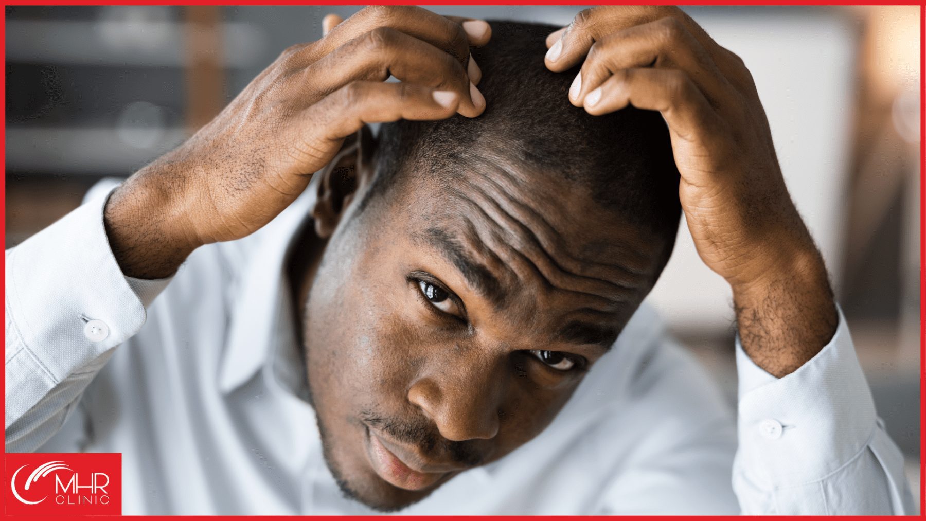 The Emotional Impact of Hair Loss
